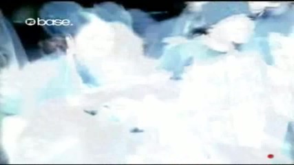 Chris Brown - Yo (excuse Me Miss)