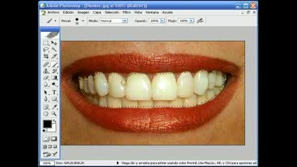 Бели Зъби На Photoshop