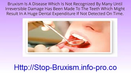 Grinding Teeth, Bruxism Treatment, Stop Teeth Grinding, How To Stop Bruxism, Grinding My Teeth