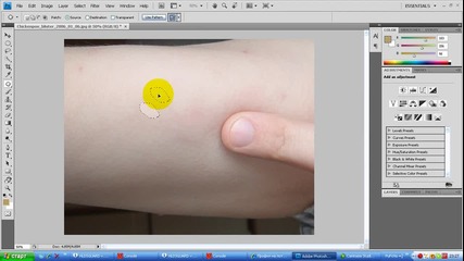 Урок* Махане на белези рани с photoshop 