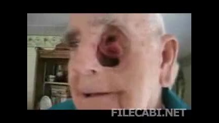 Hole in the head