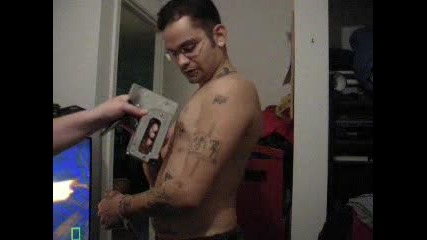 Staple Gun To The Chest Again