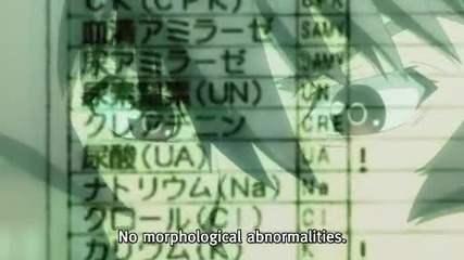 Shiki - 03 eng sub 