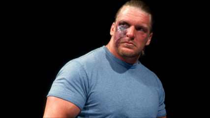 Triple H retires because of a gross snake bite: SmackDown, Oct. 14, 1999