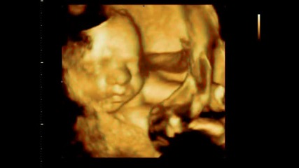 3d видеозон - бебе в осмия месец 