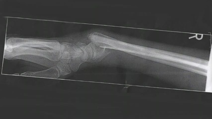 Chinamode - Bonebreaker 