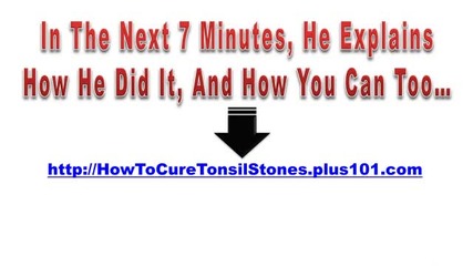 Tonsil Stones How To Remove