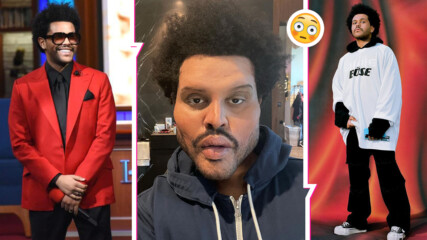 The Weeknd шокира със снимка на лицето си. Сложил ли си е наистина ботокс или е нещо друго?