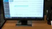 Двойно повече екипи, оборудване и линейки за Спешната помощ