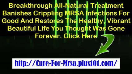 Mrsa Virus, Mrsa Early Stages, Symptoms Of Mrsa In Nose, Mrsa In The Bloodstream, Can Mrsa Be Cured
