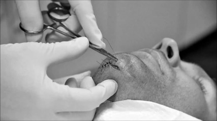 Dean Ambrose gets stitches