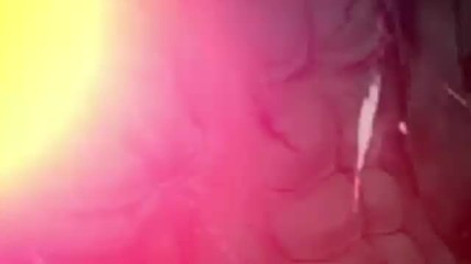 {amv} Under my skin