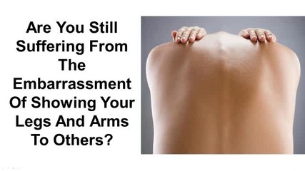 How To Get Rid Of Keratosis Pilaris