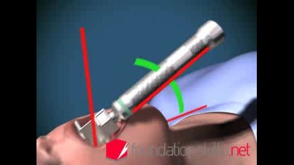 3d Медицинска Анимация!! 