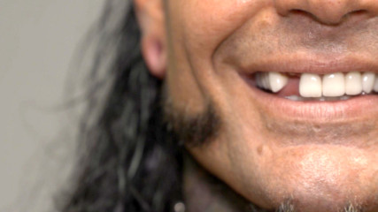 Jeff Hardy receives medical attention for his broken tooth: WWE.com Exclusive, April 30, 2017