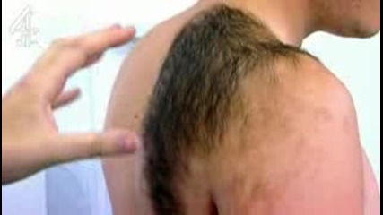 момче с ужасно окосмяване 