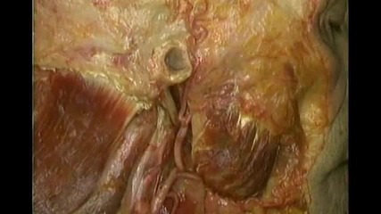 Анатомия на Arteria Carotis externa