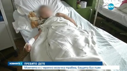 10-годишно дете е с опасност за живота, след като баща му го преби