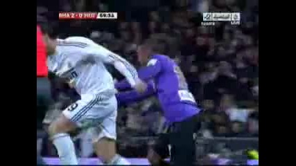 Роналдо чупи носа на противник 