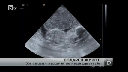 Бебе се роди здраво от майка в мозъчна смърт