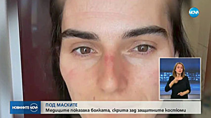 Вижте белезите и какво им се случва, но не се отказват