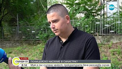 Мъж със счупена челюст: Пребиха ме полицаи без причина