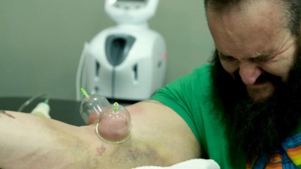 Braun Strowman's elbow surgery and harrowing rehab: Remaking The Monster - Episode 1