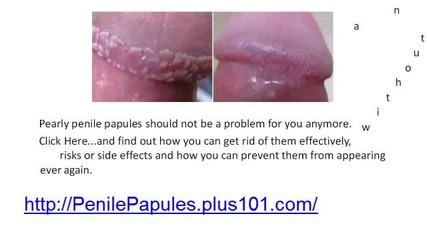 On treatment shaft papules penile Red Spots