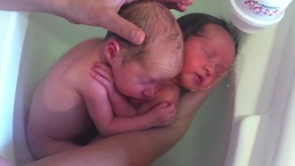 Силна връзка между новородени близнаци