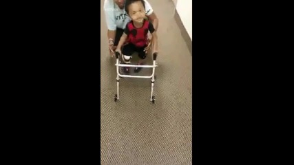 Дете на 1 година се учи да ходи с изкуствен крак!