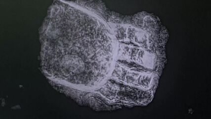 Археолози откриха средновековен скелет с метална протеза на 500 години (ВИДЕО)