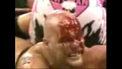 Wwe Tearing