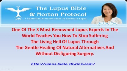 Natural Treatment for Lupus Rash 