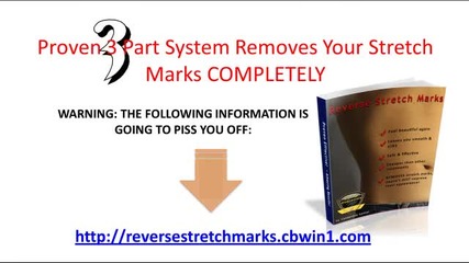 Stretch Marks Comprehensive Information