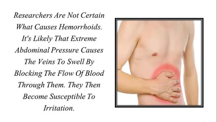 Hemroid Treatment, Treating Hemorrhoids, Hemorrhoid Removal, Bleeding Hemroids