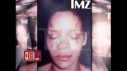 Снимката На Rihanna След Побоя С Chris Brown