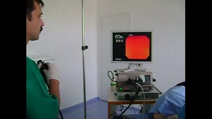Видеосигмоидоскопия 
