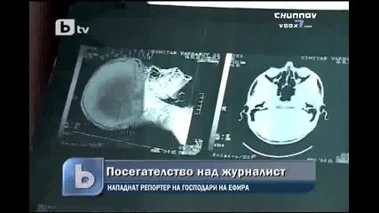 пребиха репортер с чук Бтв Новините High Quality 