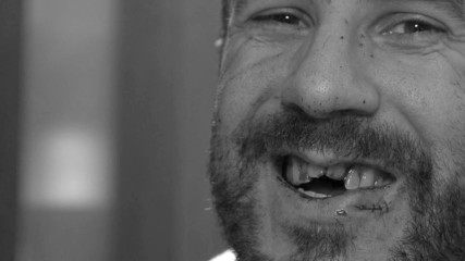 Cesaro receives stitches ahead of emergency dental work: WWE.com Exclusive, Sept. 24, 2017