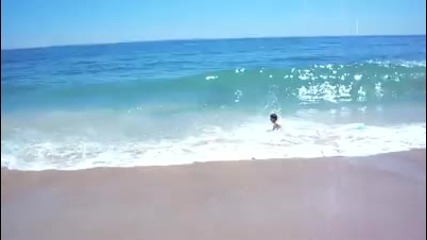 Skin Boarding Fail