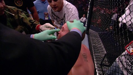 ufc thiago Alves vs. Chris Lytle