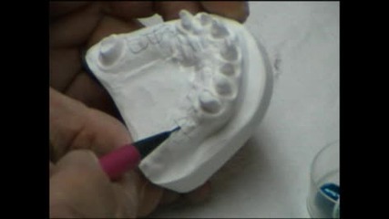 Стъклени опорни системи Dental Zx part 1