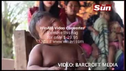 bebe na 5 godini puwi saedinenie