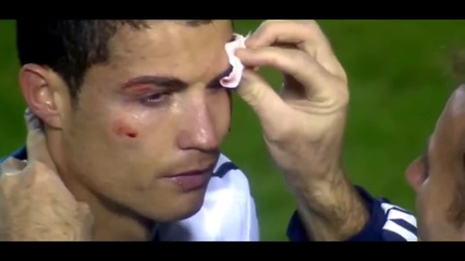 Cristiano Ronaldo's Eye Injury Vs Levante