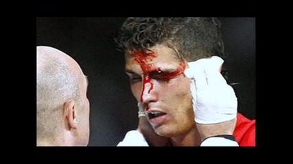 Cristiano Ronaldo Is Blinde