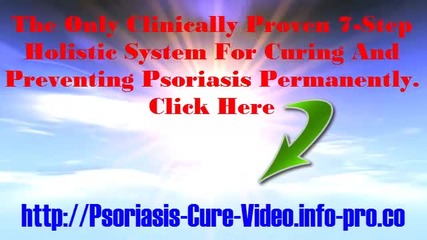 Guttate Psoriasis, Scalp Psoriasis, Home Remedies For Psoriasis, How To Treat Scalp Psoriasis