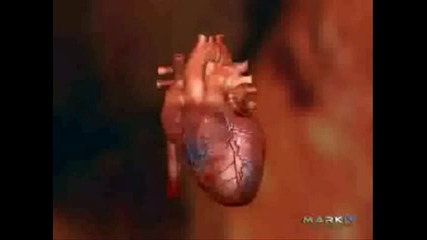 Миокарден инфаркт - Myocardial Infarction