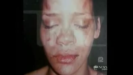 Rihanna Interview About Chris Brown On 2020 pt 1 of 5