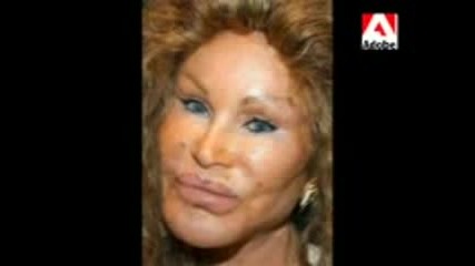 Ugly People