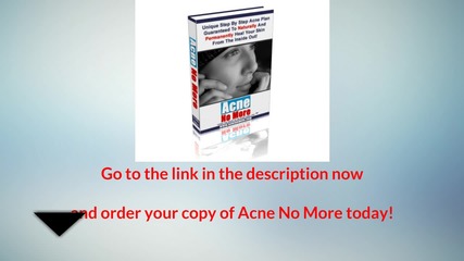 Acne No More By Mike Walden